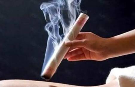 艾灸图片3 艾灸图片3